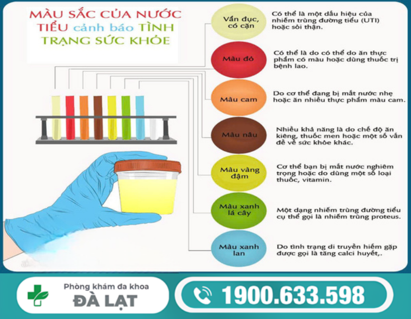 Hình ảnh minh họa